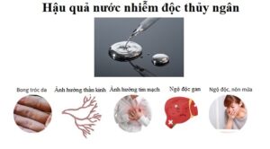 các triệu chứng ngộ độc thủy ngân