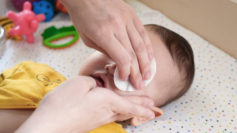 Thấm gạc vào nước muối sinh lý, lau nhẹ mắt